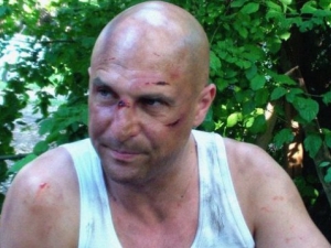 Вокалистът на група \