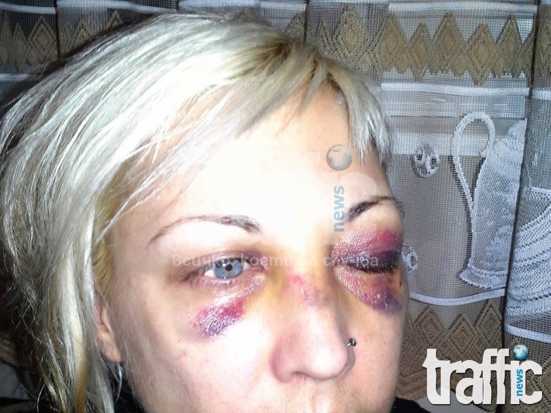 Пловдивчанка размазана от бой в метрото, обвинява полицай