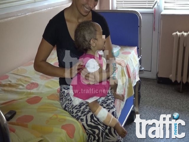 Малката Симая изглежда като дете от концлагер, лекуват я в Пловдив СНИМКИ и ВИДЕО
