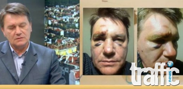 Скандал: Полицаи пребили университетски преподавател