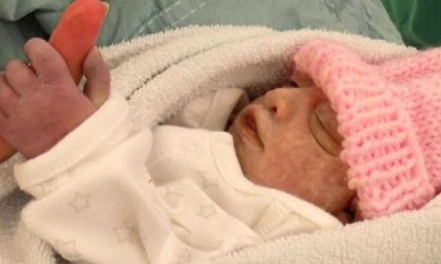 Бебе стана най-малкият донор на органи във Великобритания