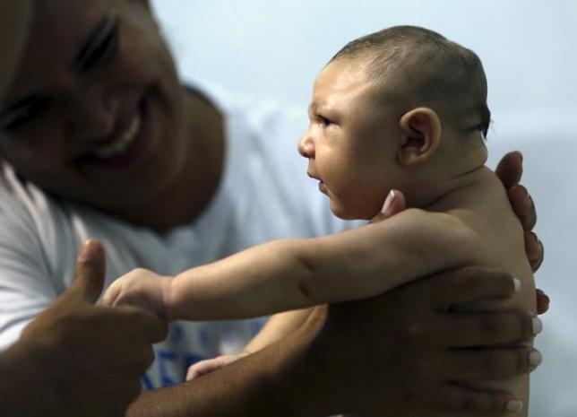 Учени от Бразилия откриха какво причинява Зика на бебета, чиито майки са боледували