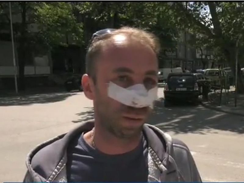 Ето го шофьора, получил юмрук в лицето от таксиджия след спор на пътя