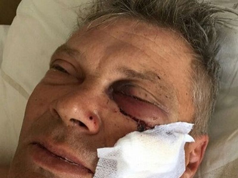 Роми с вили и лопати смляха от бой руснак и сина му СНИМКИ