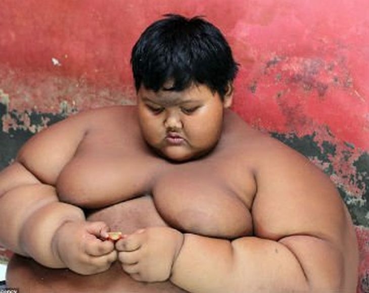 Най-дебелото дете в света мина на диета СНИМКИ