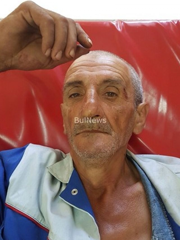 Човек на Ценко Чоков преби с бухалка работник на негов враг СНИМКИ