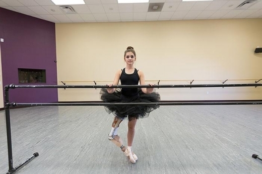 15-годишно момиче загуби крака си, но каква балерина стана! СНИМКИ+ВИДЕО