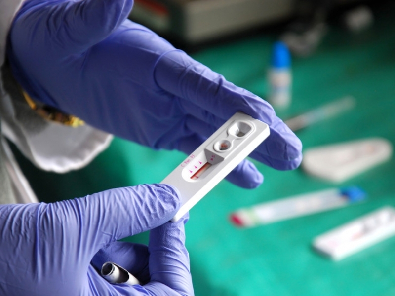 Провеждат безплатни прегледи за ХИВ/СПИН в Пловдив