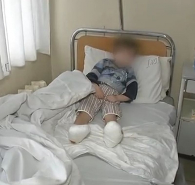 Майката на детето с измръзналите крака няма обяснение за случилото се ВИДЕО