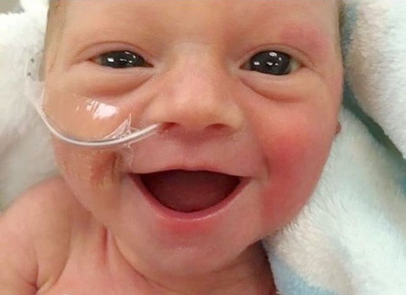 Хит в мрежата! Недоносено бебе се усмихва до уши само 5 дни след раждането си СНИМКА