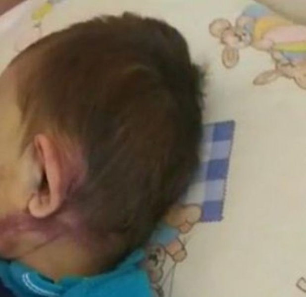 Десетки помагат на 2-годишния Васко, пребит от майка му ВИДЕО