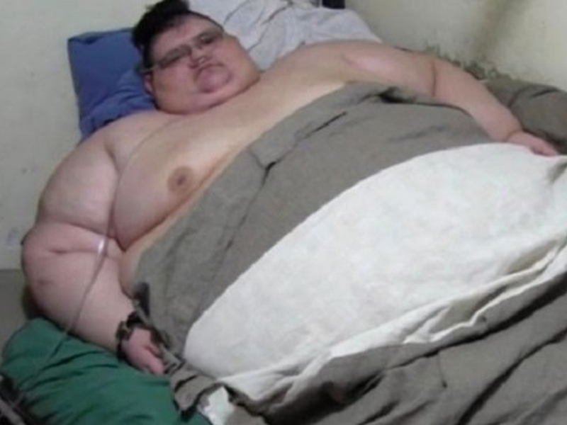 Оперират най-тежкия мъж на света, доскоро тежал почти 600 килограма СНИМКА