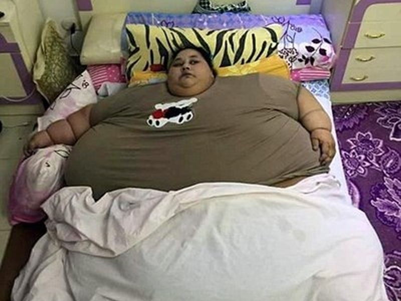 Най-дебелата жена на света отслабна с 242 килограма