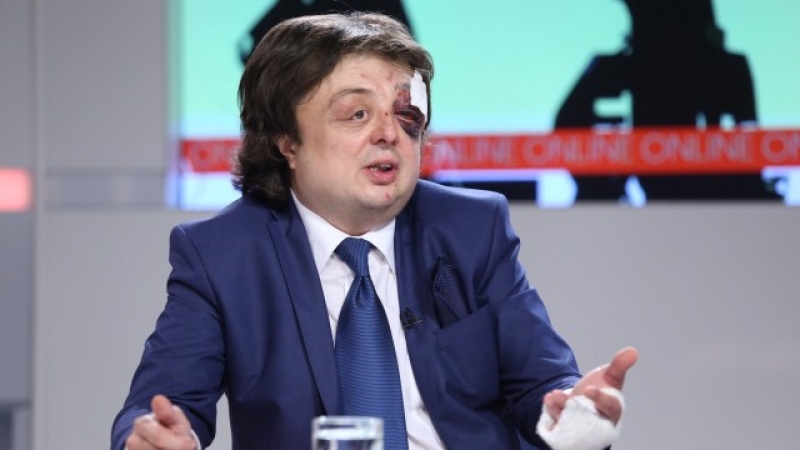 Брутално пребитият Григор Здравков: Поръча ме Митко Каратиста,  но закъсня