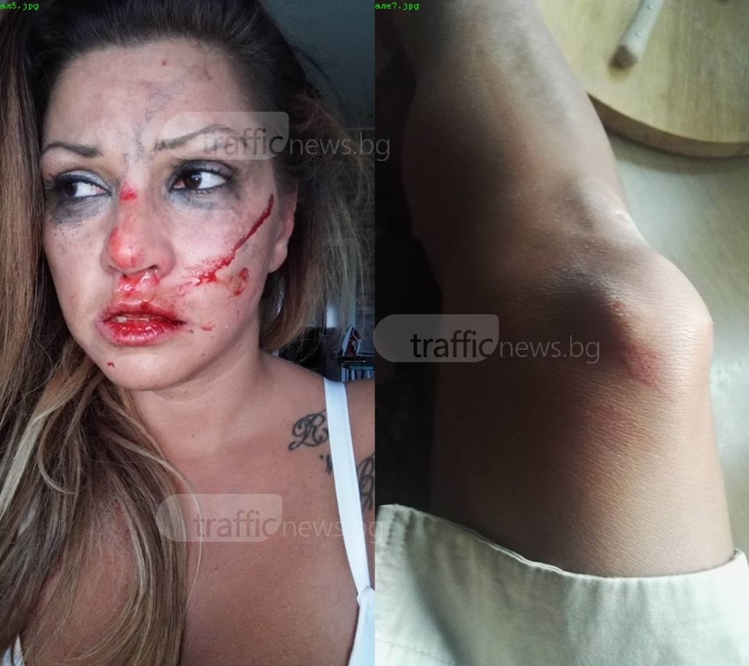 Пловдивска звезда от Х Фактор бе пребита брутално от гаджето си швед СНИМКИ