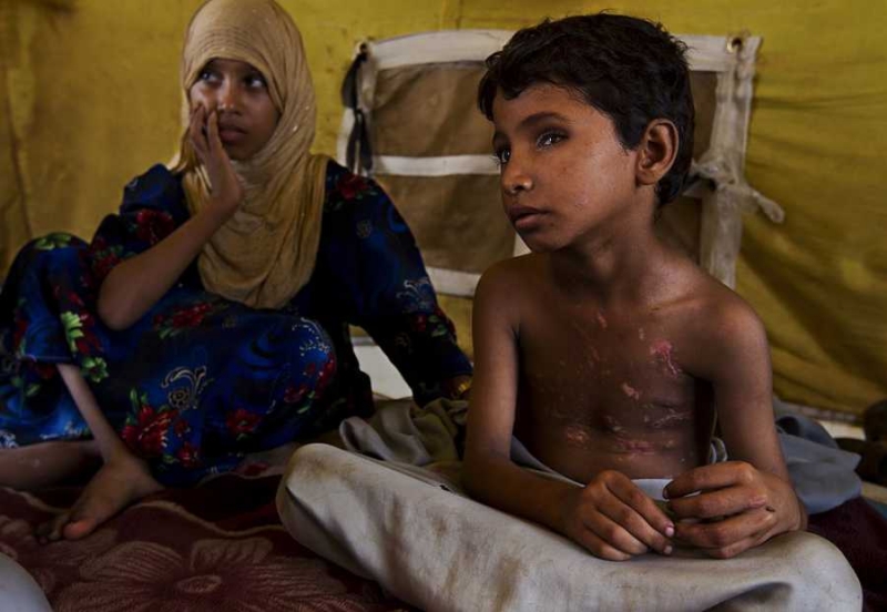 1500 гинат от холера в Йемен за два месеца