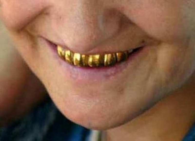 Крадец от Раковски удари дъното! Задигна златните зъби на жена, докато тя спи