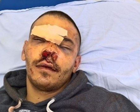 Двама в ареста за 72 часа заради бруталния побой на млад мъж след спор на пътя СНИМКИ