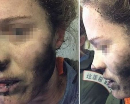 Инцидент в самолет: Слушалки гръмнаха в лицето на момиче по време на полет СНИМКА