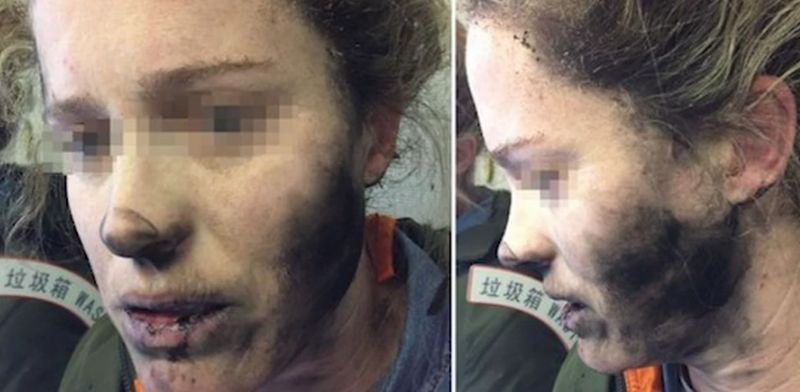Инцидент в самолет: Слушалки гръмнаха в лицето на момиче по време на полет СНИМКА