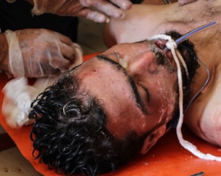 100 жертви и десетки ранени при взрив в бежански лагер