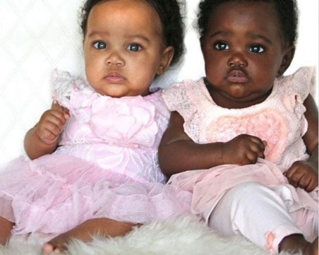 Изумителните бебета близначки с различен цвят на кожата станаха хит в Инстаграм