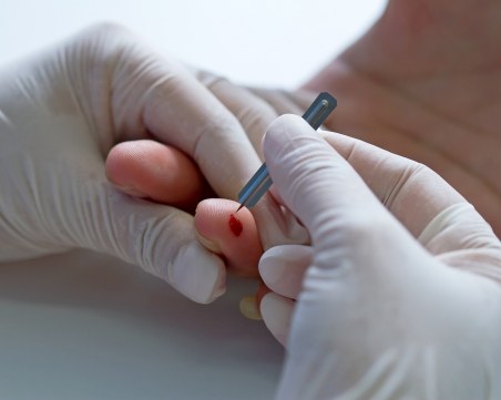 Противораково лекарство дава надежда за лечението на СПИН