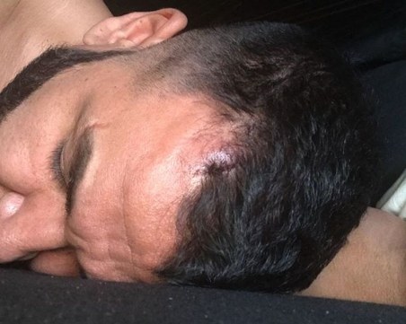 Азис си разцепи главата по време на концерт, попи кръвта и продължи да пее СНИМКИ