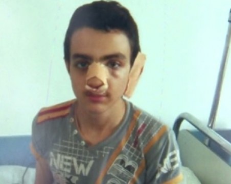 Пребитият петокласник в училище не иска да се върне в клас