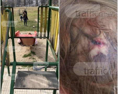 Инцидент в Тракия! Дете си разби главата на стара и изгнила пързалка СНИМКИ