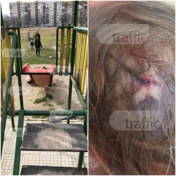 Инцидент в Тракия! Дете си разби главата на стара и изгнила пързалка СНИМКИ