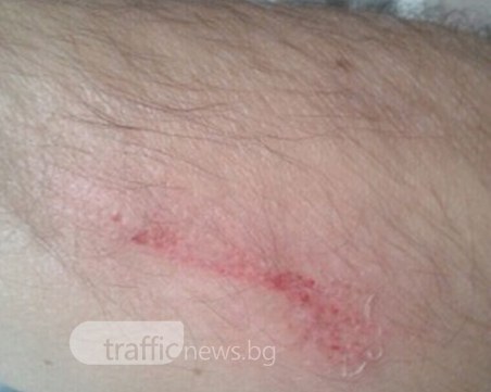 Опасно хлъзгаво в... Лекси! Пловдивчанин падна по стълбите лошо СНИМКИ