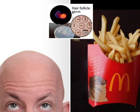 Картофките от Макдоналдс - лек срещу плешивост?