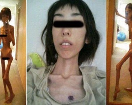Жестоко! Жена стана 16 килограма, след като дядо й я държал принудително гладна