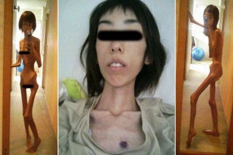 Жестоко! Жена стана 16 килограма, след като дядо й я държал принудително гладна