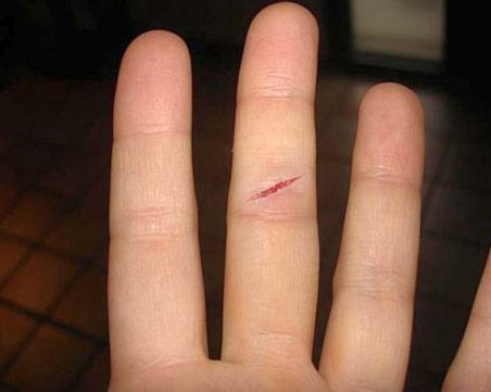 Защо ни боли толкова много, като си порежем пръста с лист хартия?