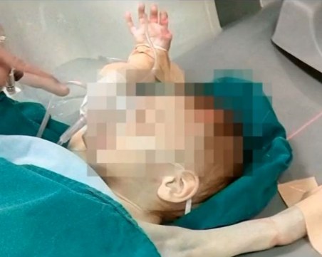 Арестуваха пияна майка, подозират я в побой над 3-годишните й близначета в Пловдив ВИДЕО