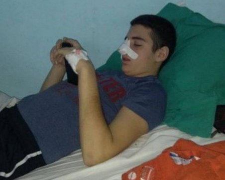 Извеждат от изкуствената кома пребития 18-годишен Илиян