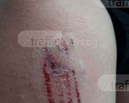 Хъски нападна пловдивчанка и кучето й в Кършияка СНИМКА