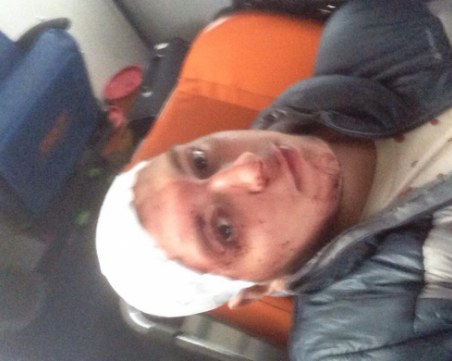 Жестоко пребитото 16-годишно момче е с 8 шева на главата