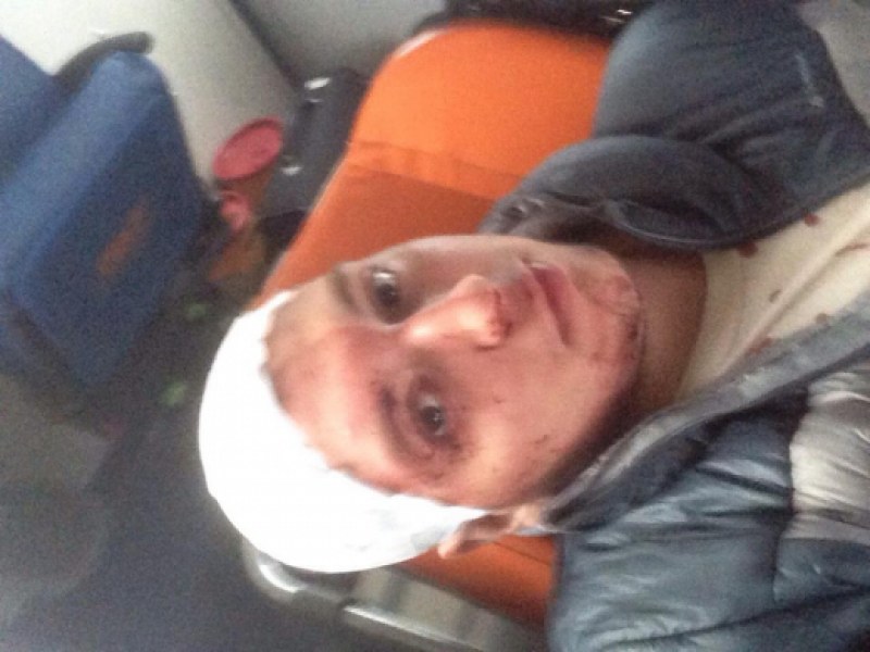 Жестоко пребитото 16-годишно момче е с 8 шева на главата