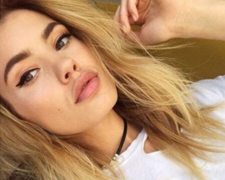 Добри новини: Моделът Кристин Илиева вече е по-добре, тъканите й бързо се възстановяват