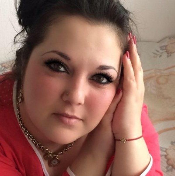 Стана ясно коя е жената, залята с киселина СНИМКА