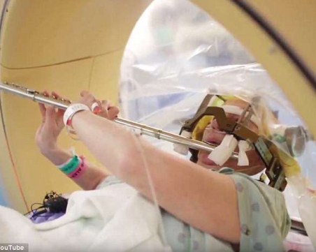 Чудо: пациентка свири на флейта по време на мозъчна операция, лекарите я аплодират ВИДЕО