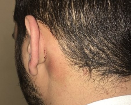 Млад мъж: Полицаи ме пребиха от бой във Велинград, заплашиха ме с изнасилване