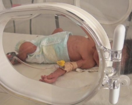 Бебе без бъбреци се роди в Пловдив и почина
