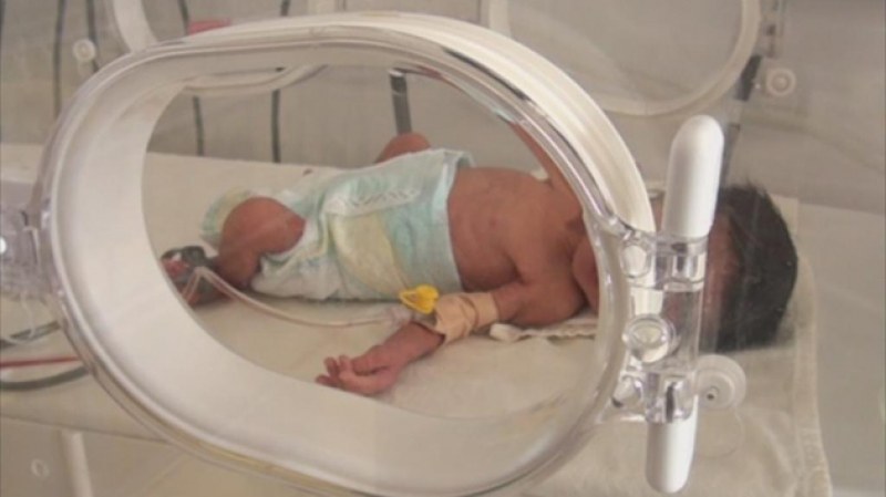 Бебе без бъбреци се роди в Пловдив и почина