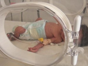 Бебе без бъбреци се роди в Пловдив и почина
