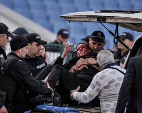 Ранената полицайка проговори за пръв път след инцидента на дербито