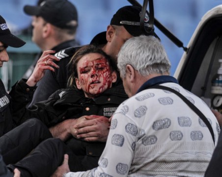 Хулиганът, хвърлил бомбичката, ранила полицайка, остава окончателно в ареста